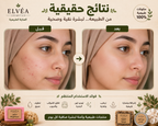 🌿بوكس 4 انواع من الصابون و مزيل العرق صٌنع طبيعي